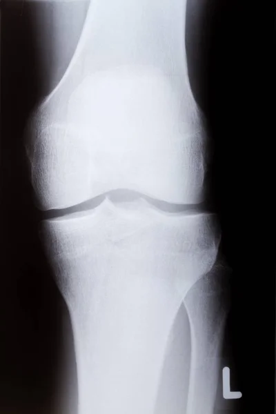 Human knee in front — Stock Photo, Image