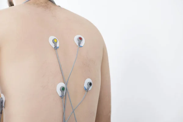 Patient With Electrostimulator Electrodes Attached On Back — Stock Photo, Image