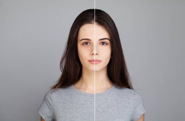 Genç kadın cilt sorunu ile Model. Kadın yüzü, sağlıklı