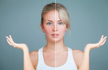 Young Woman with hands raised. Perfect Skin and Skin Problem. 
