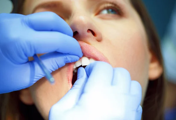 Kvinde får en tandbehandling - Stock-foto