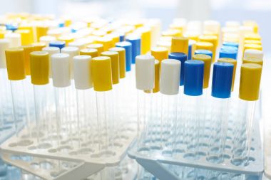 Tıbbi test tüpleri yakın çekim