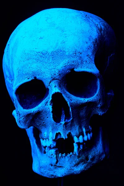 人类的头颅骨的 x 光照片 — 图库照片