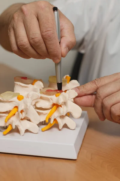 Médico explica modelo de columna vertebral en su consultorio en el hospital — Foto de Stock