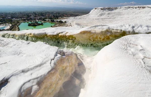 Pamukkale Kaplıcaları, Türkiye