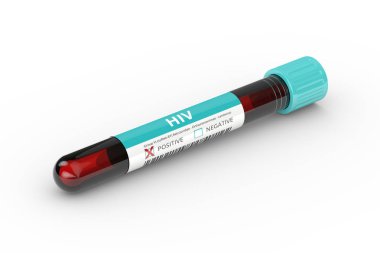 tüp HIV virüsü kan örneği ile 3D render