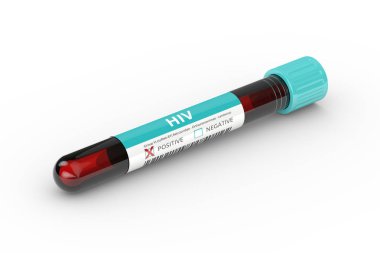 3D rendering of test tube with  HIV virus blood sample clipart