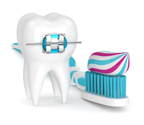3D візуалізація зубів з брекетами та зубною щіткою — стокове фото