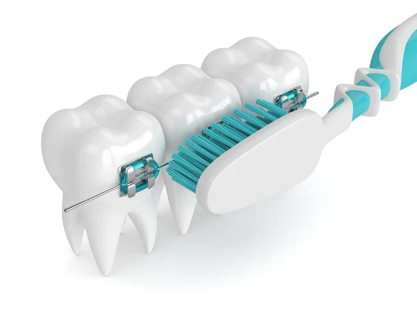 3d renderizado de dientes con frenos y cepillo de dientes — Foto de Stock