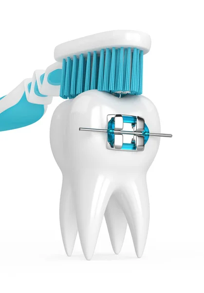 3d rendu de dent avec attelle et brosse à dents — Photo