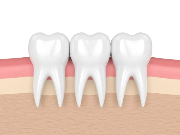 Rendering 3d dei denti nelle gengive — Foto Stock