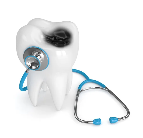 3d renderan gigi dengan peluruhan dan stetoskop — Stok Foto