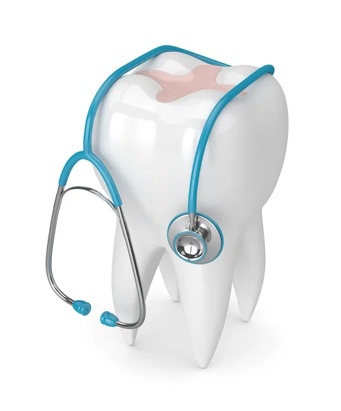 3d render of tooth with dental inlay and stethoscope