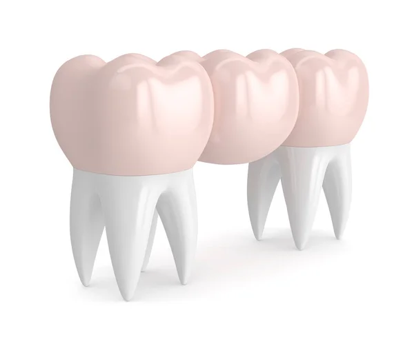 3D render dentystycznych most z korony dentystyczne — Zdjęcie stockowe