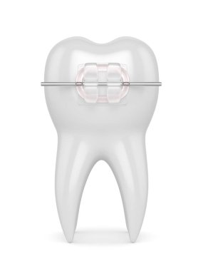 Diş seramik Açık ayraç ile 3D render
