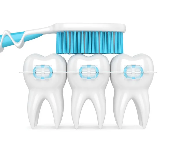3d renderan gigi dengan kawat gigi dan sikat gigi — Stok Foto