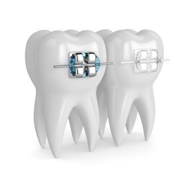 Diş seramik ve metal imleri ile 3D render