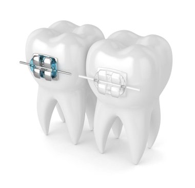 Diş seramik ve metal imleri ile 3D render