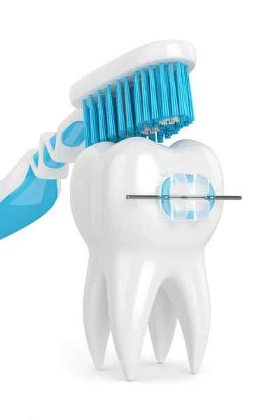 3d render of tooth with braces and toothbrush — Stock Photo, Image