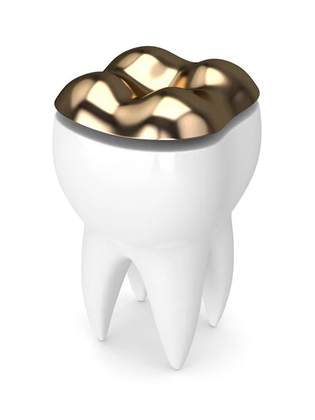 3D-Rendering des Zahnes mit Zahngoldfüllung — Stockfoto