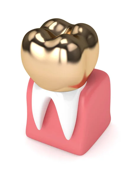 3-й рендеринг зуба с заполнением зубов золотой короной — стоковое фото