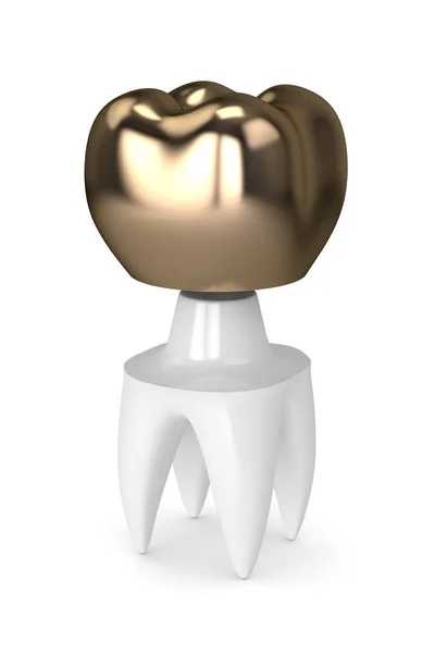 3-й рендеринг зуба с заполнением зубов золотой короной — стоковое фото