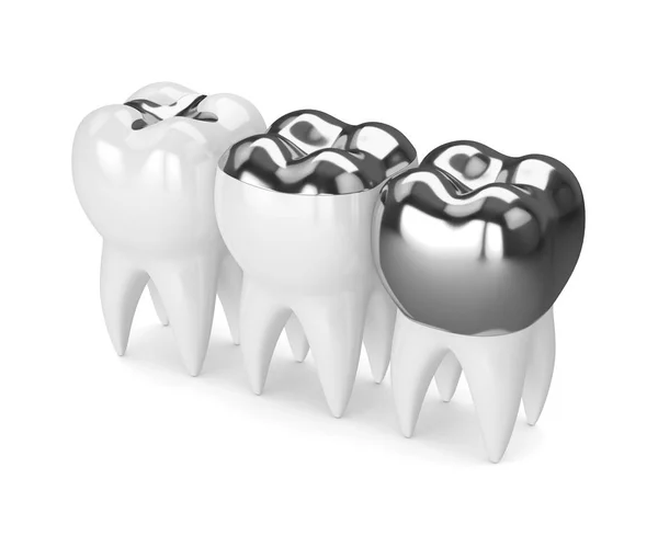 3D візуалізація зубів з різними типами зубного об'єднання — стокове фото