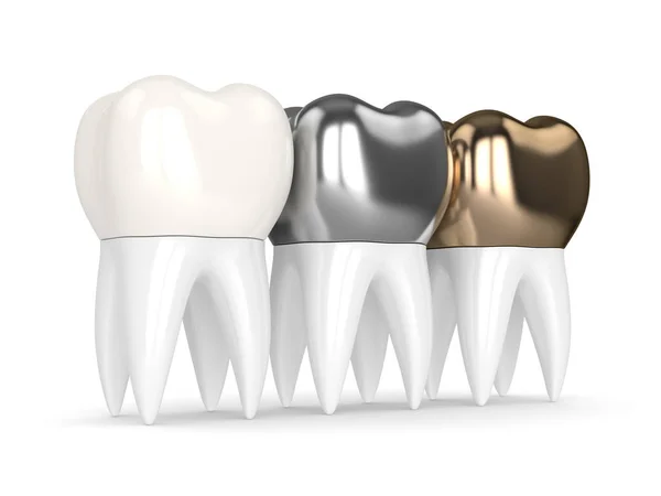 3d renderização de dentes com diferentes tipos de coroa dental — Fotografia de Stock