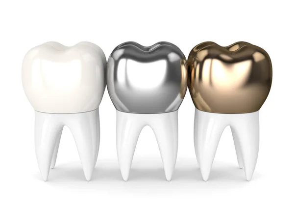Rendering 3d di denti con diversi tipi di corona dentale — Foto Stock