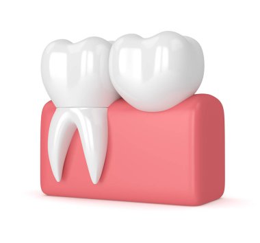 diş diş köprü prensibine göre ile 3D render 