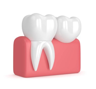 diş diş köprü prensibine göre ile 3D render 