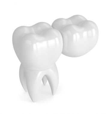 3d render of teeth with dental cantilever bridge  clipart