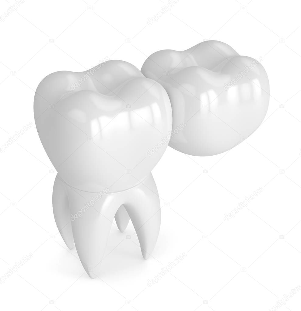 3d render of teeth with dental cantilever bridge 