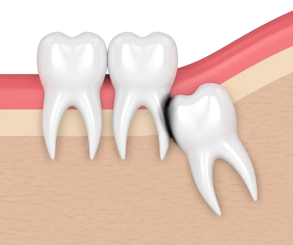 3d render of wisdom with erosion cavity — Stock Photo, Image