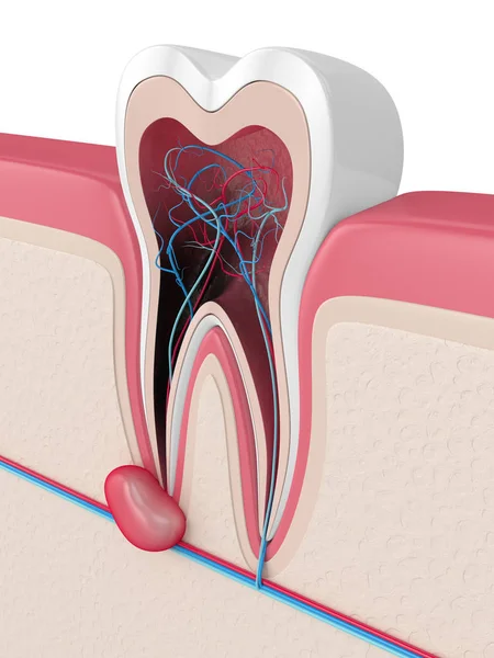 낭종 이 있는 잇몸에 치아를 3D 로 렌더링하는 일 — 스톡 사진