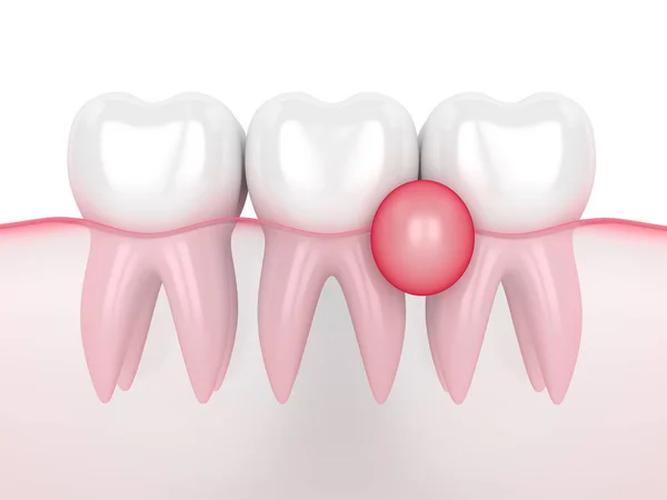 Gingivale Images Libres De Droit Photos De Gingivale Depositphotos