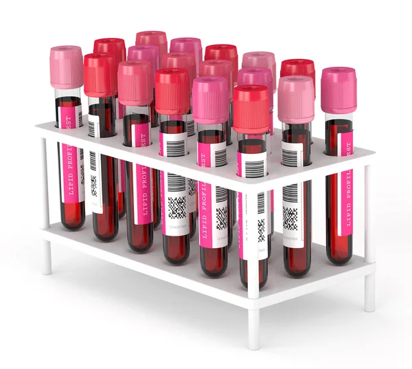 Renderização 3d com amostras de sangue de teste de perfil lipídico — Fotografia de Stock