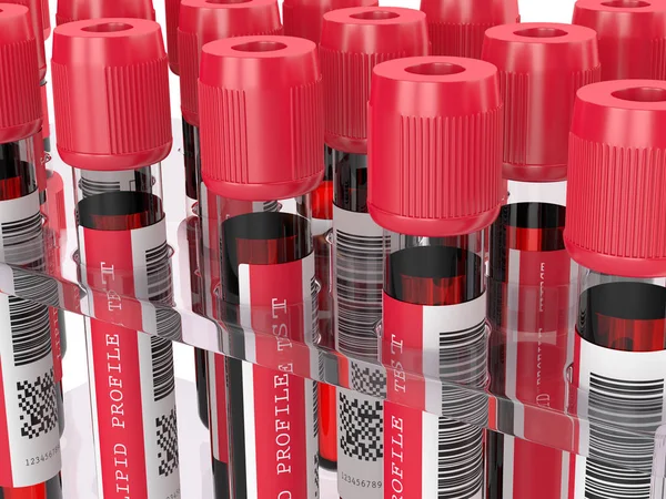 3d render with lipid profile test blood samples — 스톡 사진