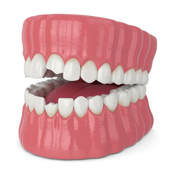 Rendering 3d della mascella con incisivi rotti denti — Foto Stock