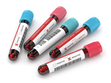 Beyaz zemin üzerinde 3D Coronavirus 2019-nCoV kan örnekleri