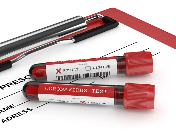 Renderizado Coronavirus 2019 Ncov Muestras Sangre Que Yacen Portapapeles — Foto de Stock