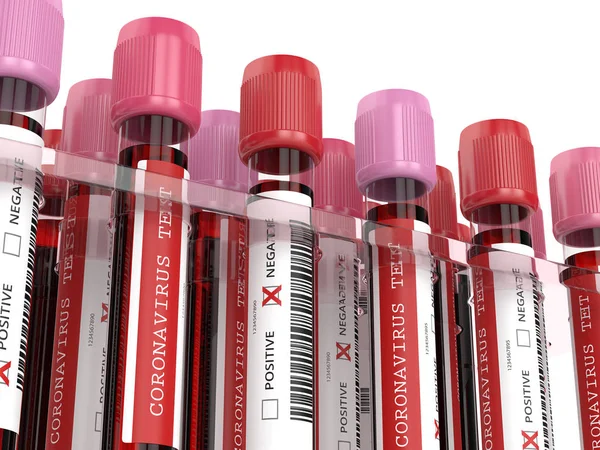 Render Coronavirus 2019 Ncov Blood Samples Rack — Stock Photo, Image