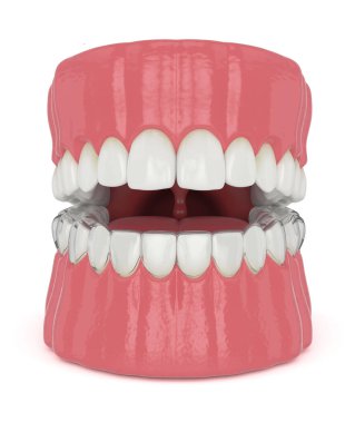 Beyaz arkaplan üzerinde geçersiz kılınabilir koruyuculu 3d çene oluşturucu