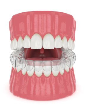 Beyaz arkaplan üzerinde çene ile geçersiz kıldırılabilir ayırıcı ile 3d oluşturucu