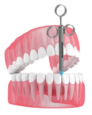 3 boyutlu çene ve şırınga ve diş anestezisi. Diş tedavisi kavramı.