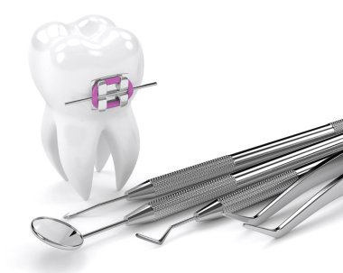 Diş telleri ve beyaz arkaplan üzerinde diş tanılama araçları ile 3D oluşturma