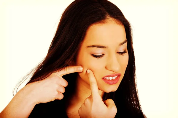 Teenage woman squeezing pimple. — Stock Photo, Image