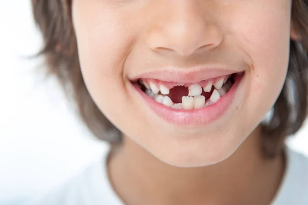 Jovem Menino Perdeu Seu Dente — Fotografia de Stock