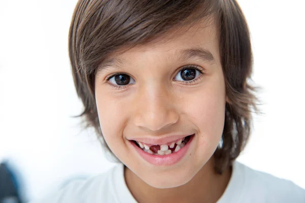 少年は歯を失った — ストック写真