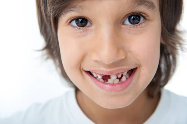 Jovem Menino Perdeu Seu Dente — Fotografia de Stock